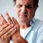 rheumatoid arthritis
