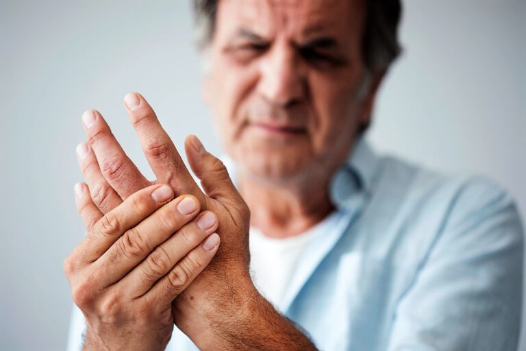 rheumatoid arthritis